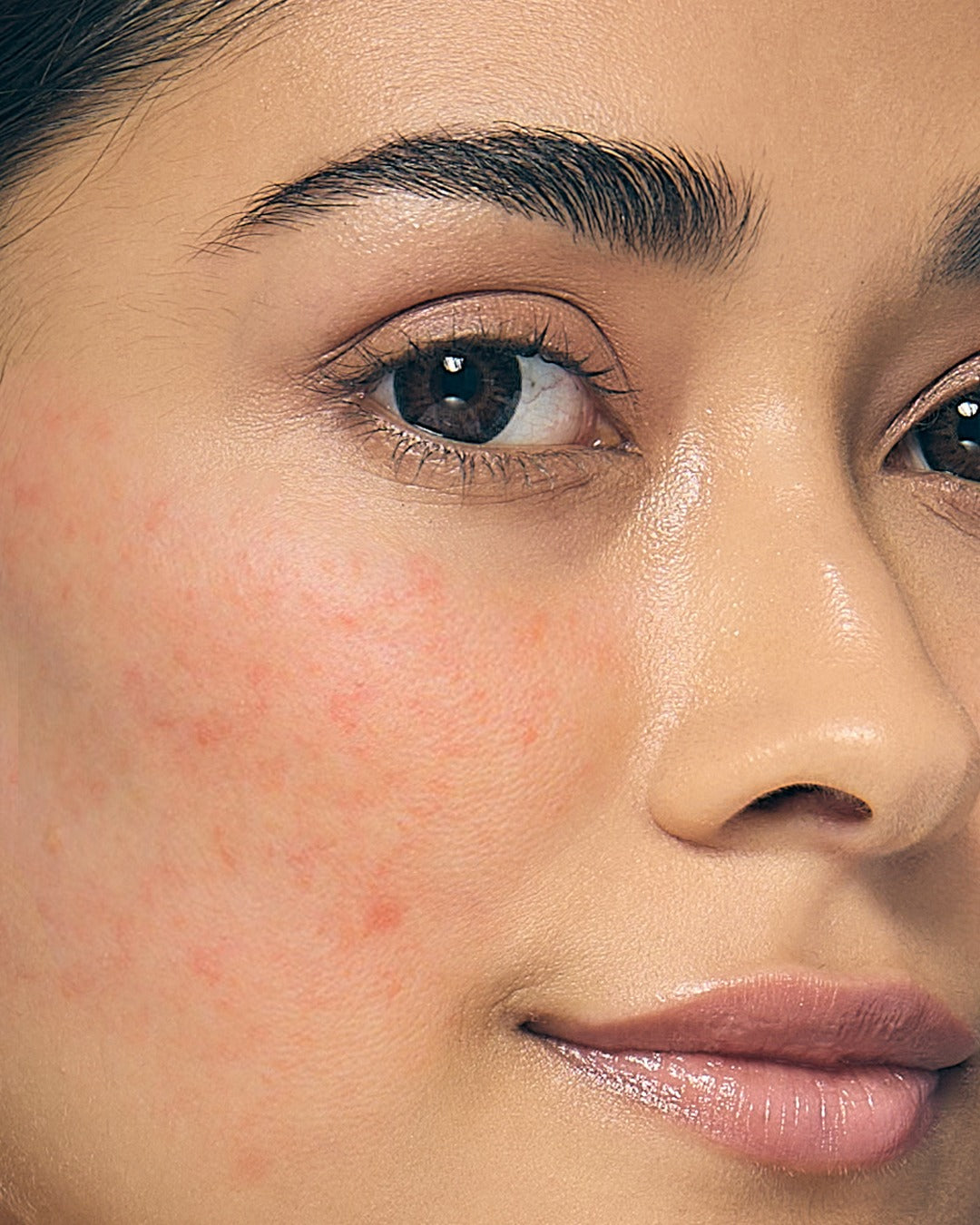 The Perfect Skincare Routine for Sensitive Skin (Simple & Effective)